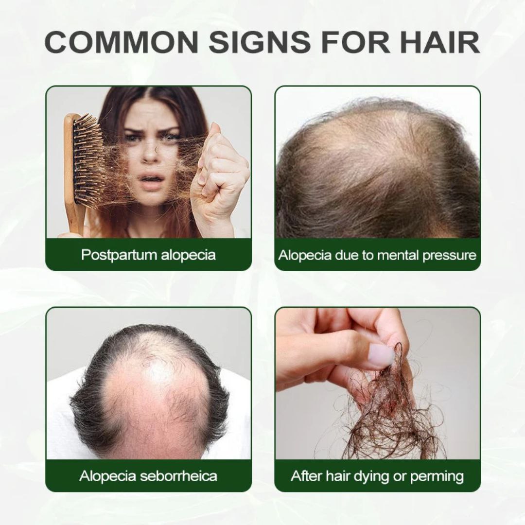 Huile de Romarin 2 en 1 – Pour des Cheveux Plus Forts et une Peau Éclatante Soin Naturel Revitalisant et Nourrissant