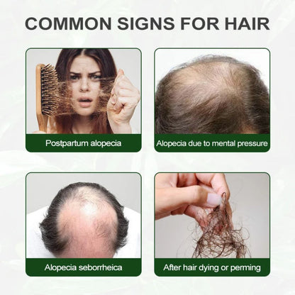 Huile de Romarin 2 en 1 – Pour des Cheveux Plus Forts et une Peau Éclatante Soin Naturel Revitalisant et Nourrissant